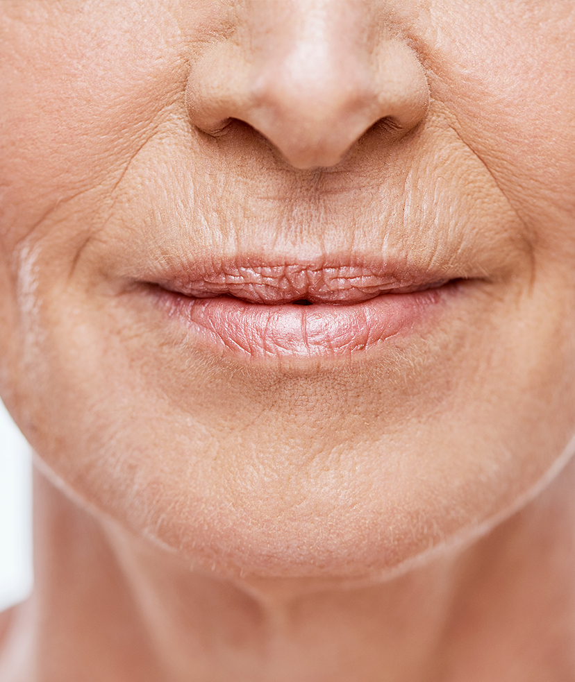 Photo of wrinkles and fine lines around an older woman's lips