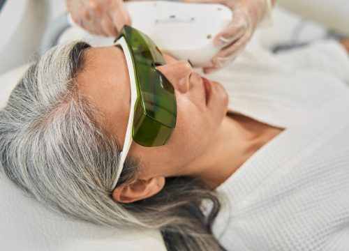 Photo of a woman getting laser aesthetic treatments